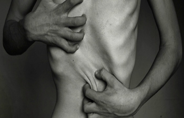 michele_anoressia_comingout3