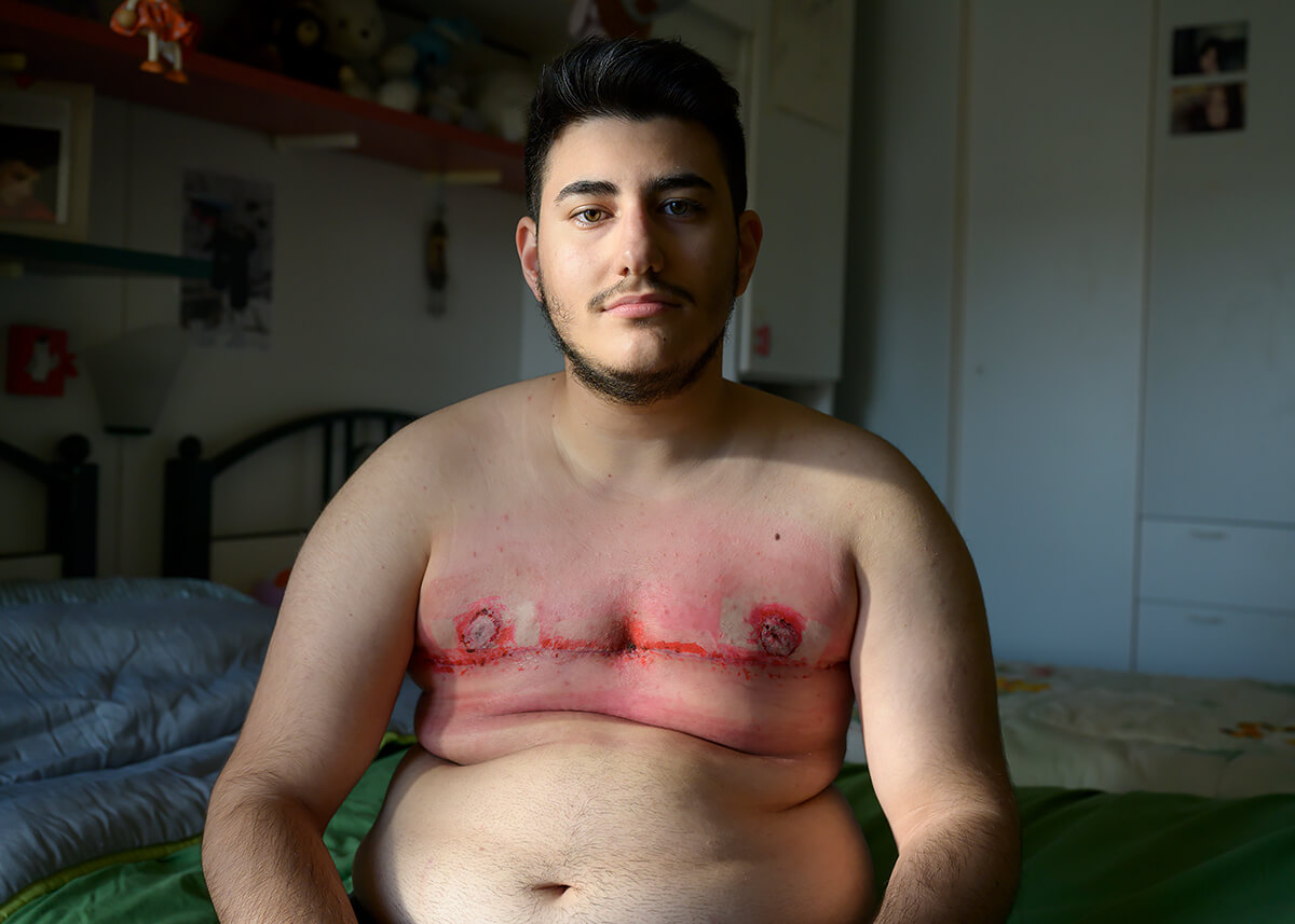 La storia di Gabriel, il ragazzo FtM in finale al concorso All about photo  di New York